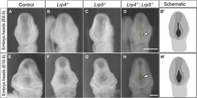 Balancing WNT signalling in early forebrain development: The role of LRP4 as a modulator of LRP6 function